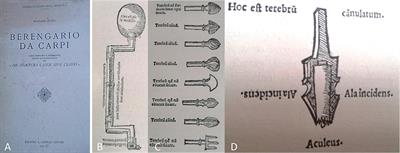 The History of Decompressive Craniectomy in Traumatic Brain Injury